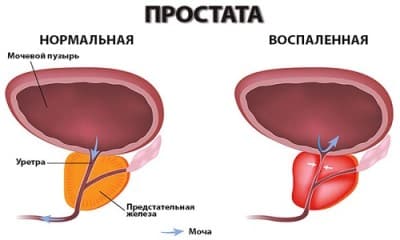 Иллюстрация 4 Иллюстрация 4