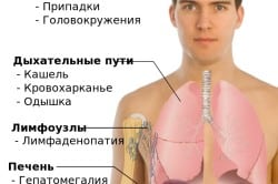 Основные места и симптомы метастазов рака