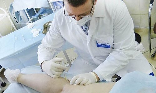 Для проведения микросклеротерапии используется раствор — склерозант, который вводится специалистом в просвет поврежденных сосудов