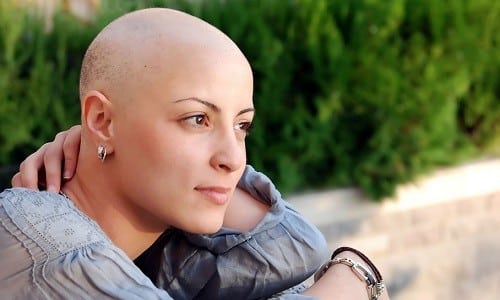 Выпадение волос при химиотерапии
